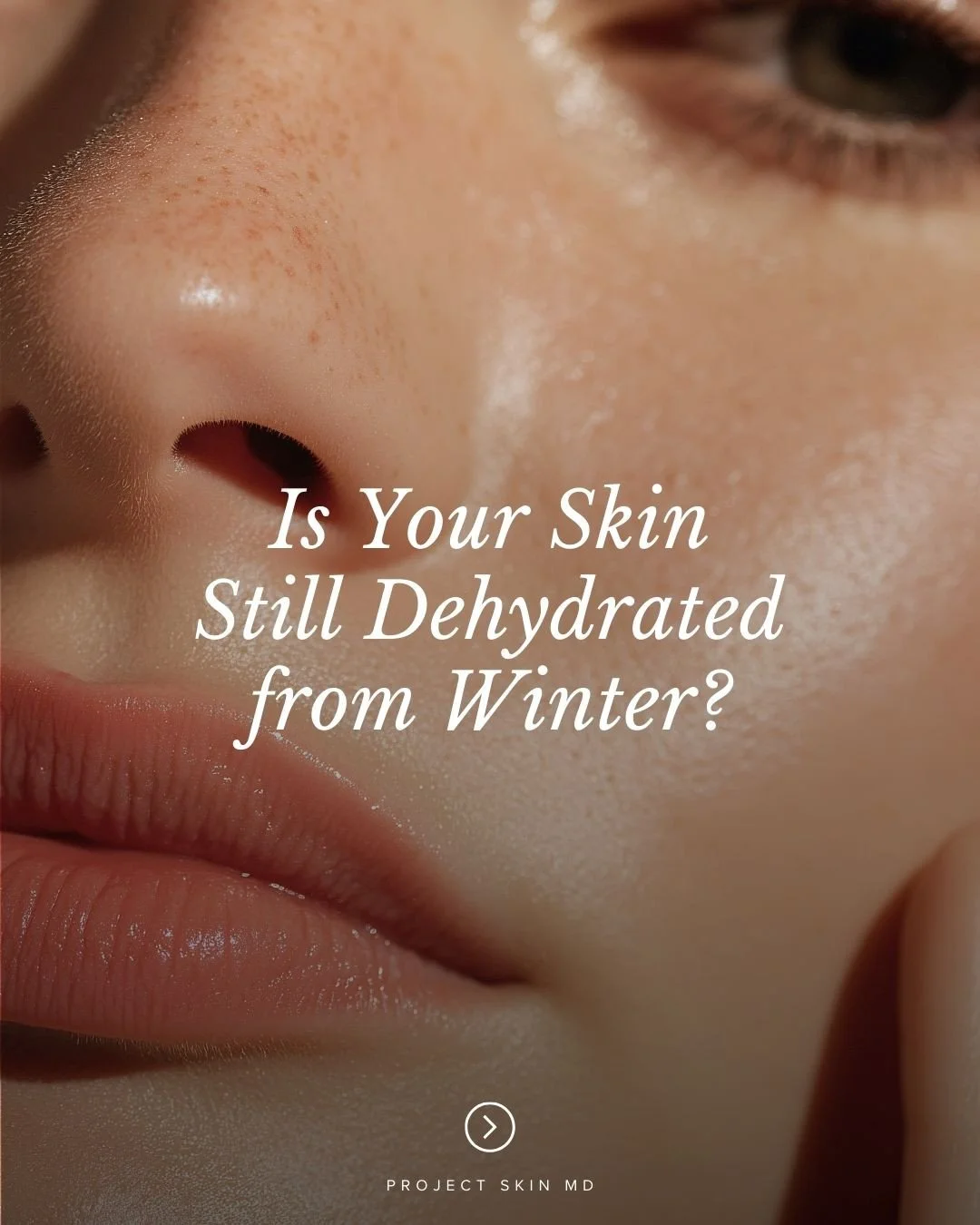 Get Your Post-winter Glow-up ✨⁠
⁠
Is your skin still feeling dehydrated after those long winter months?⁠
⁠
The transition into spring is the perfect time to restore hydration and rebuild your skin health from within. Cold weather can often compromise
