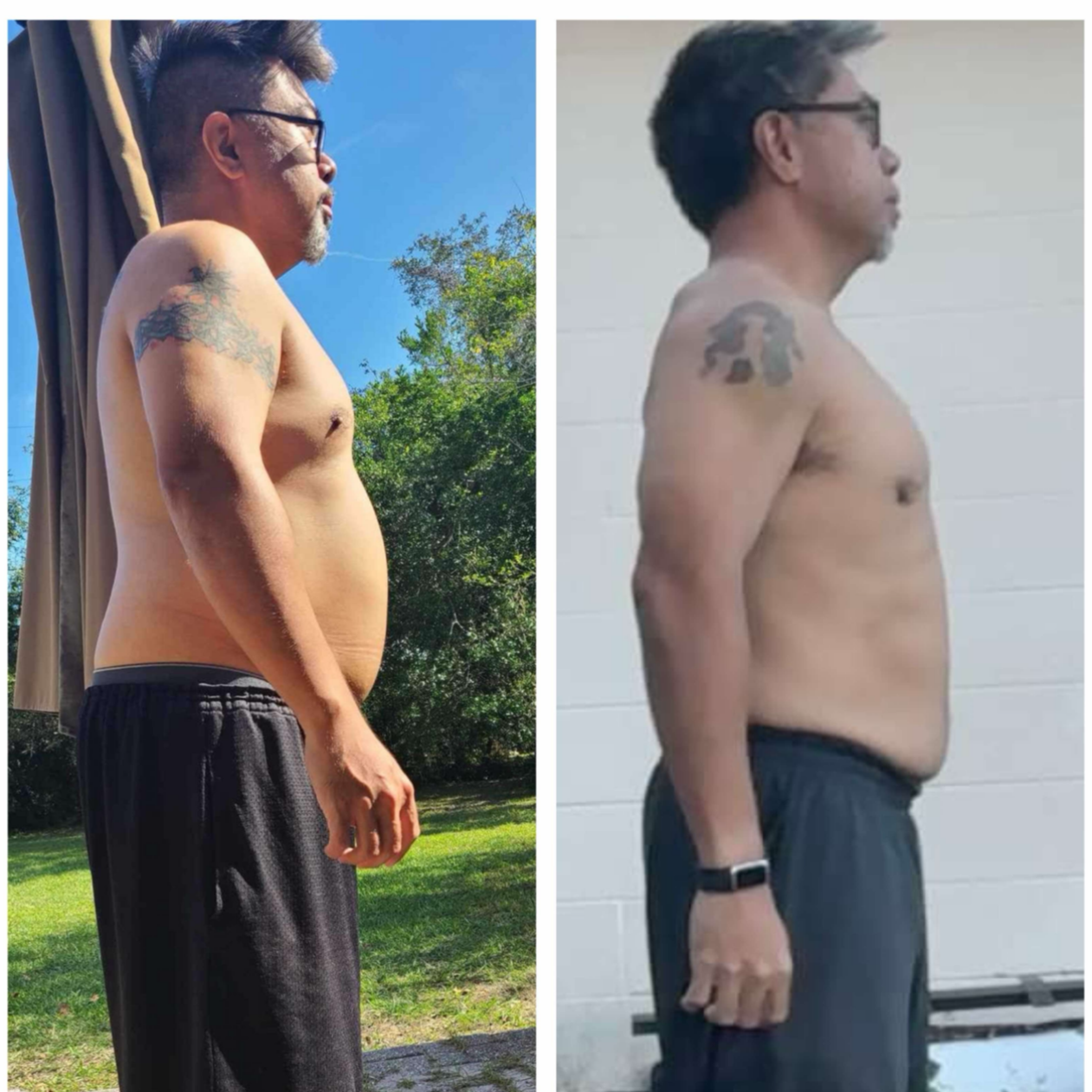 Man Before and After of Weight Loss