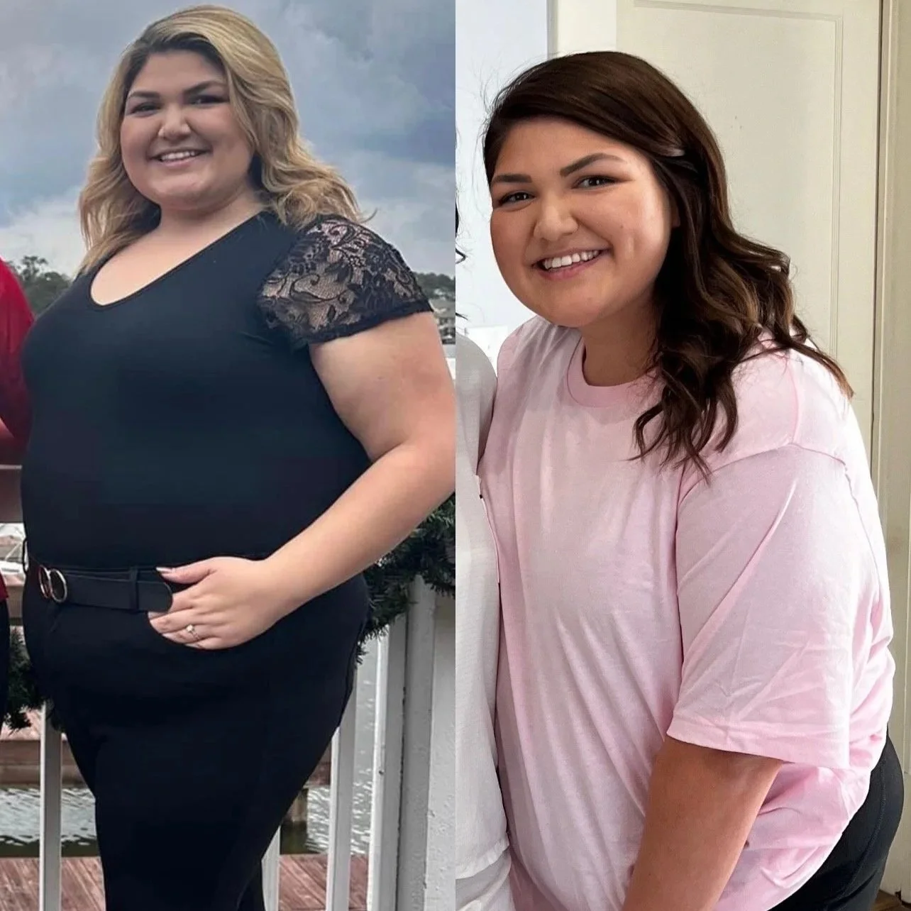 Woman Before and After of Weight Loss