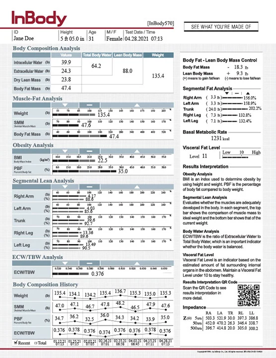 Sample InBody 570 body composition report showing skeletal muscle mass, body fat percentage, segmental analysis and progress over time