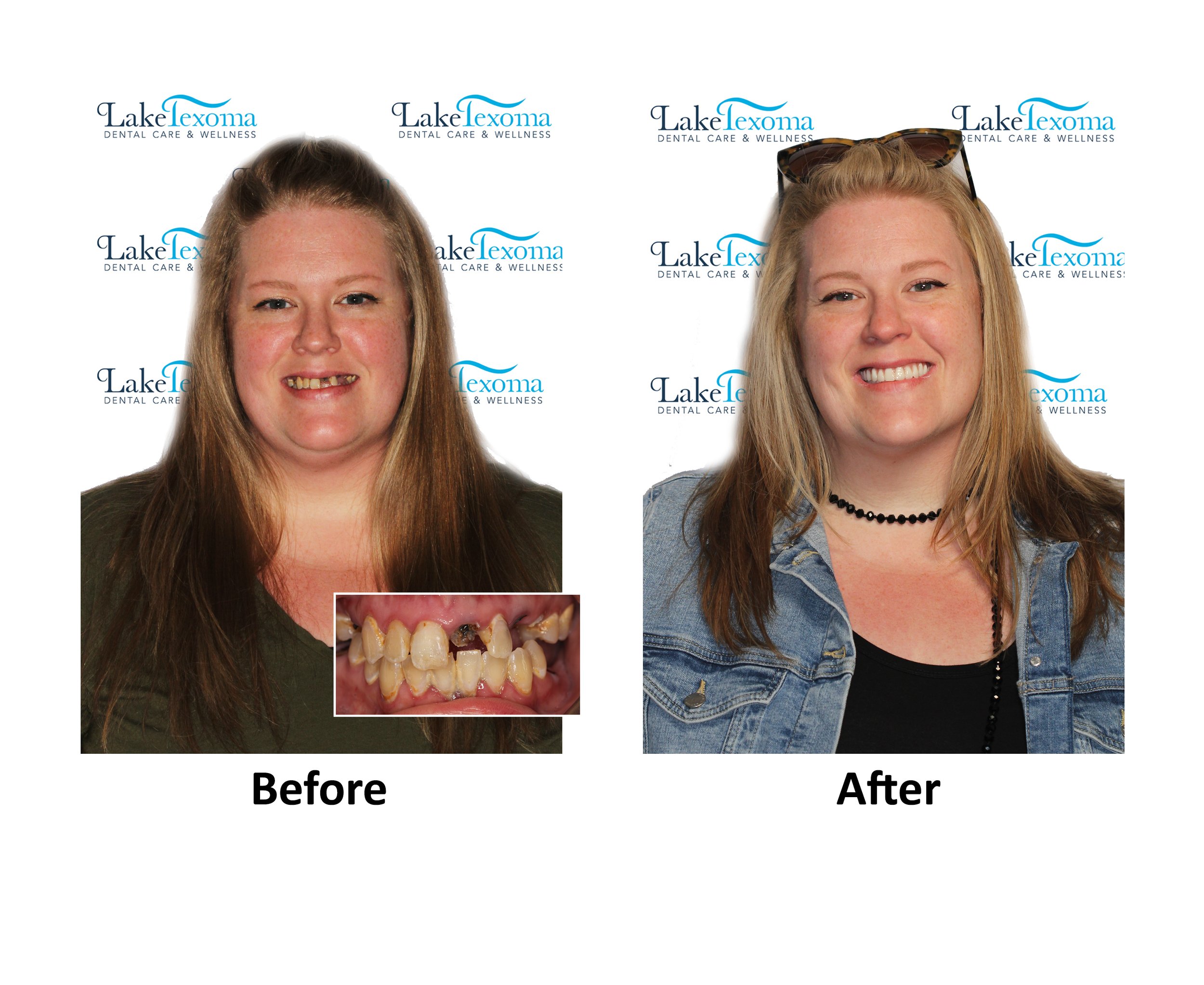 C Walker- TIAD - Before After .jpg