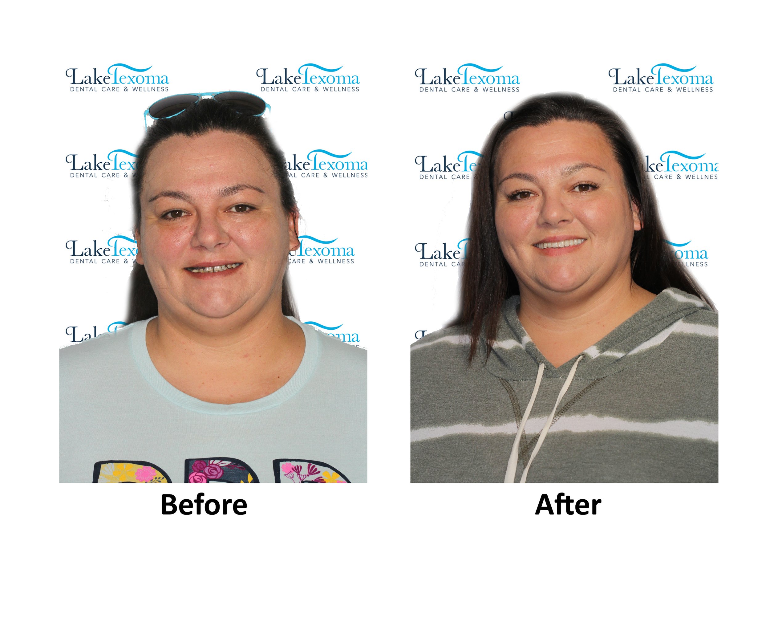 J Bridges - TIAD - Before After .jpg