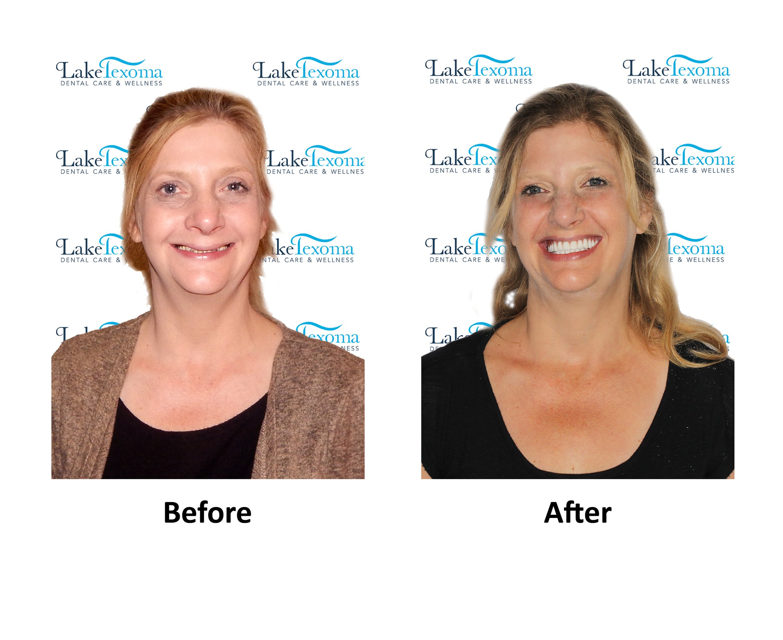 J P - Before After.jpg