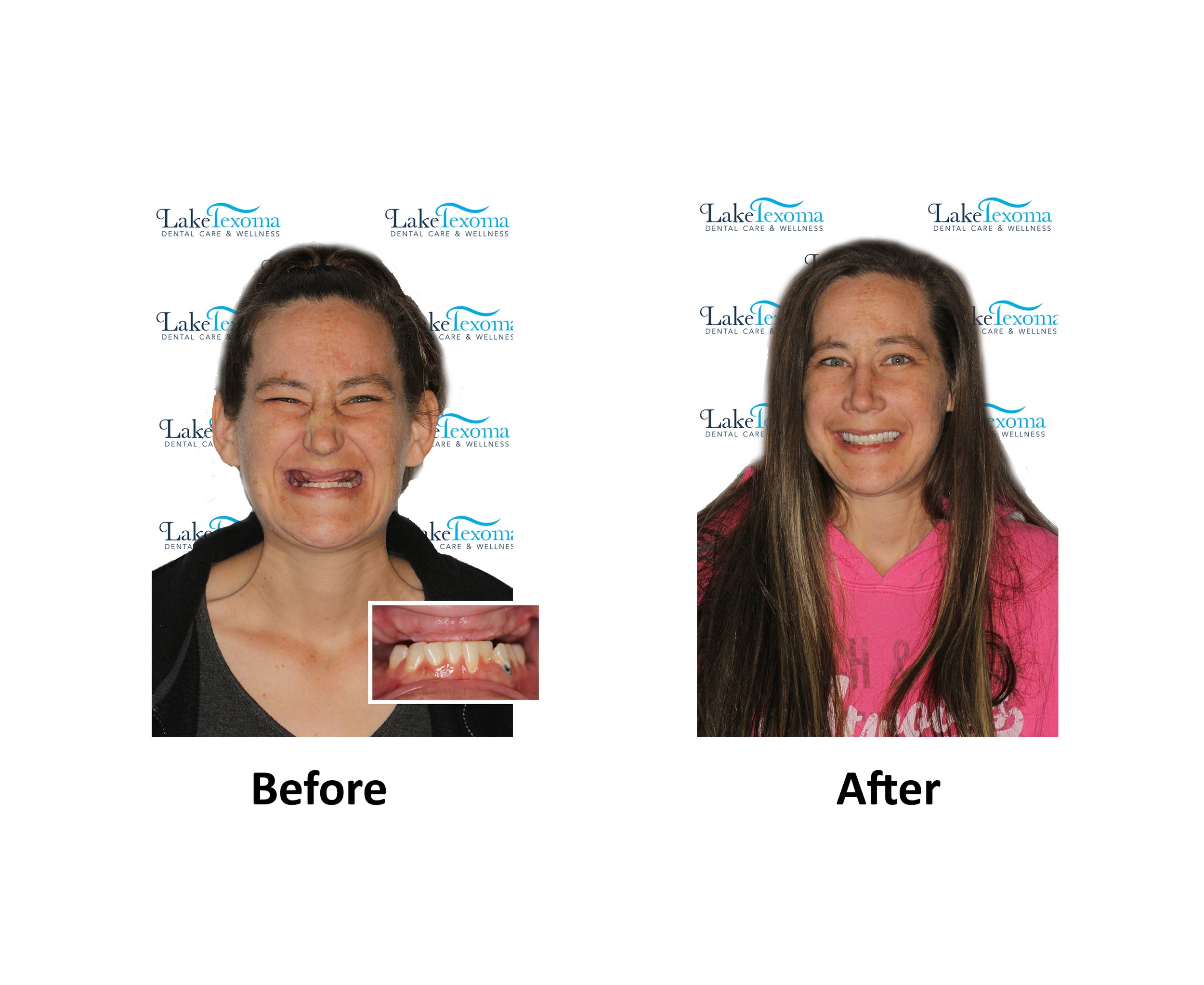 C Miller - TIAD - Before After .jpg