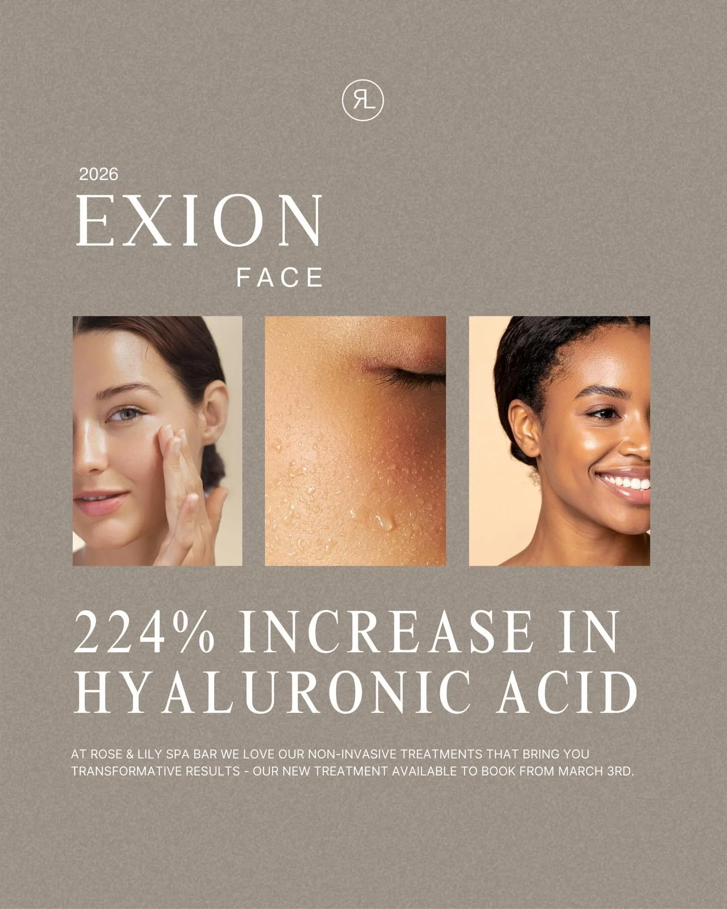 NEW TREATMENT: The natural alternative to Profhilo 💫

224% increase of hyaluronic acid from ONE treatment! 

✍🏼 Non-invasive 
✍🏼 No downtime 

Keep your eyes peeled for some transformative results on our stories &amp; upcoming posts 🤍

Launching 