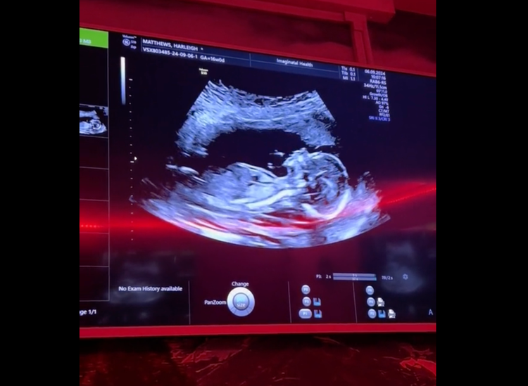 Bonding and wellbeing scan ultrasound profile at Imaginatal