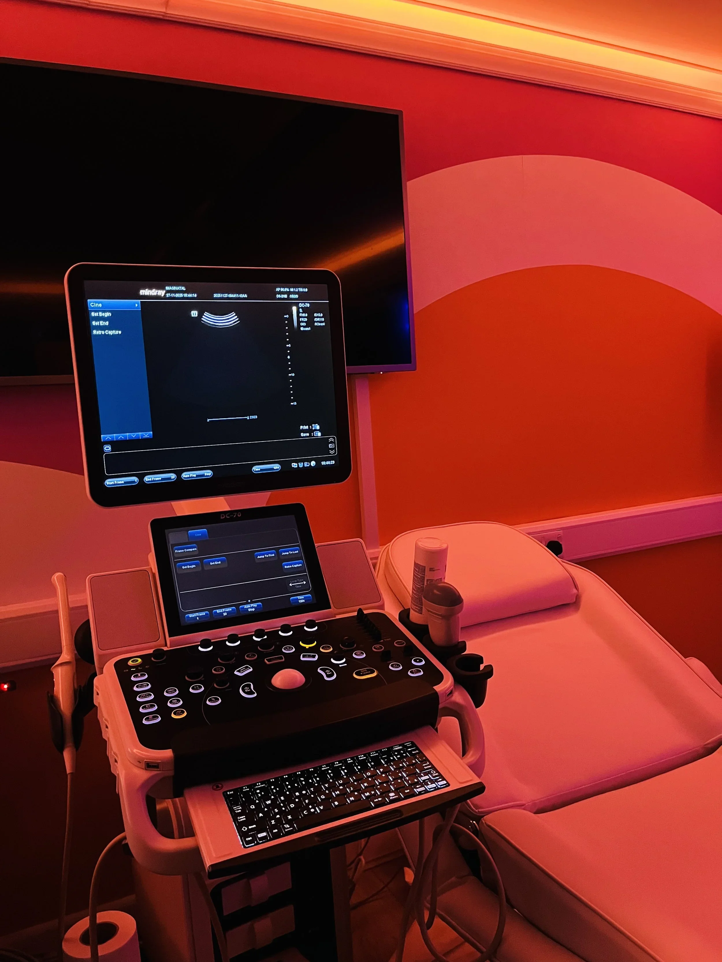 Advanced ultrasound scan machine at Imaginatal Romford private pregnancy scan clinic
