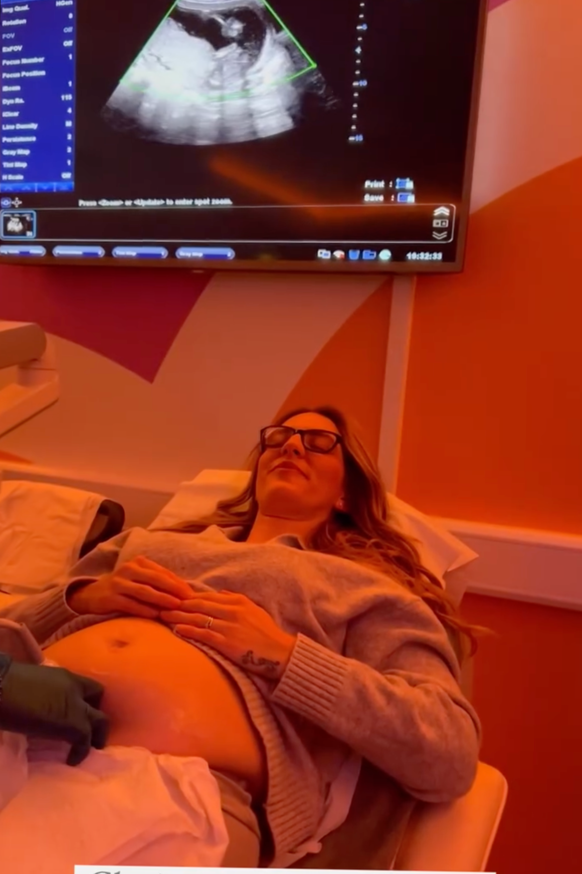 Ultrasound scan monitor displaying a baby during a pregnancy scan session at Imaginatal clinic