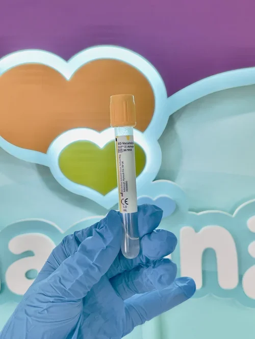 Blood collection yellow tube held by a clinician for private blood tests and health screening at Imaginatal
