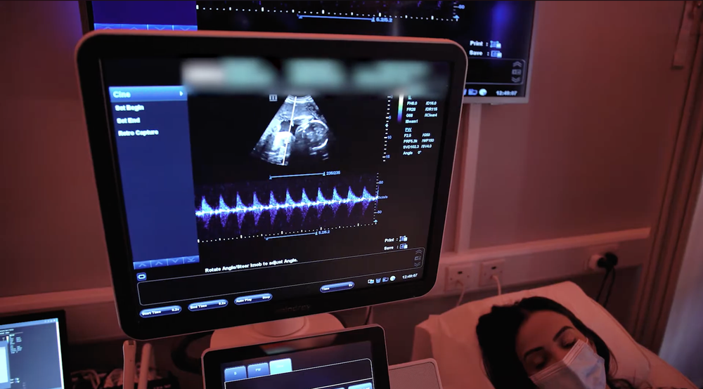 An ultrasound scan in an Imaginatal clinic