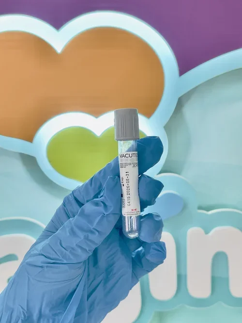 Blood sample collection grey tube held by a clinician for private blood testing at Imaginatal