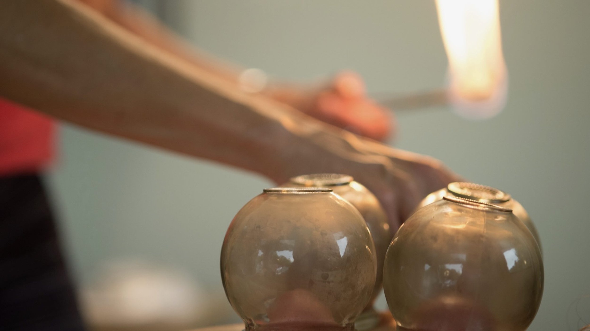 Cupping & Gua Sha