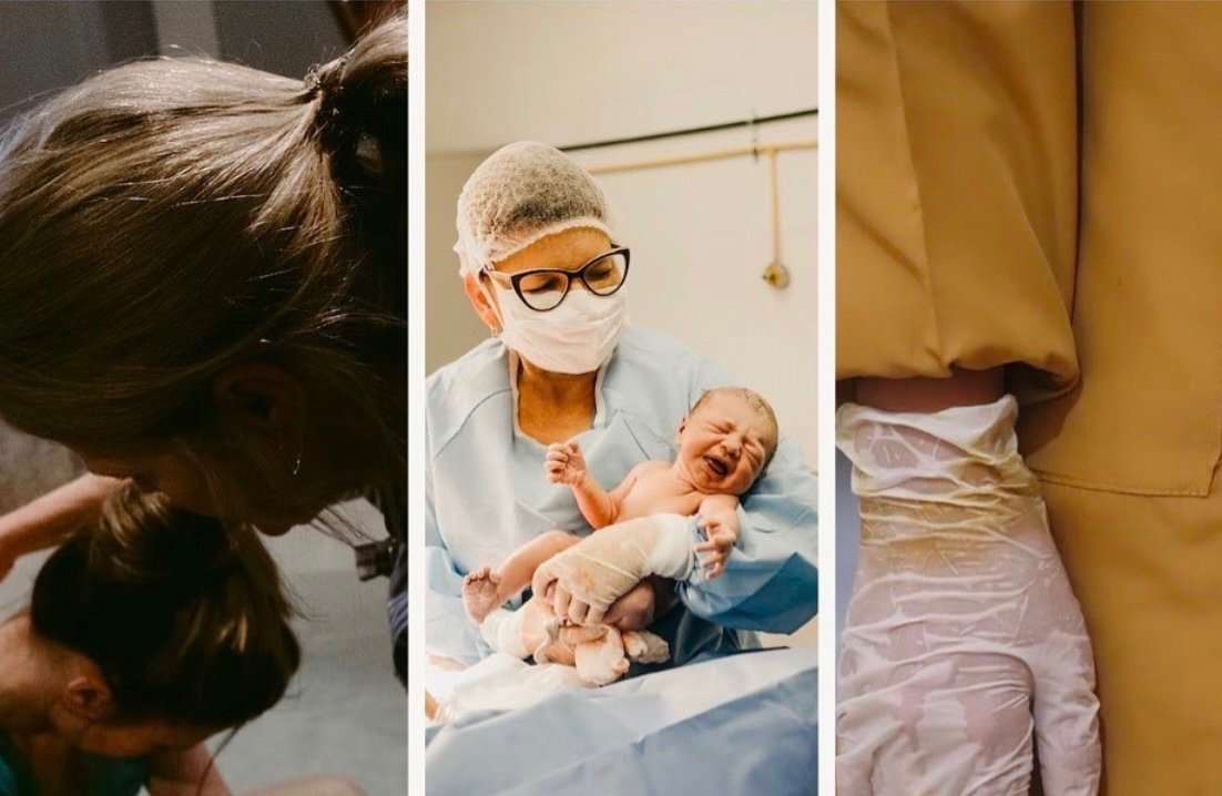 pregnancy after birth trauma