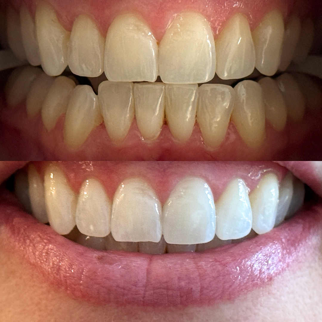 Copy of Copy of Copy of Copy of Copy of Copy of Copy of Copy of Copy of Copy of Copy of Copy of Copy of Copy of Copy of Copy of Copy of Copy of Copy of Copy of Copy of Copy of Copy of Copy of Copy 3.png.PNG