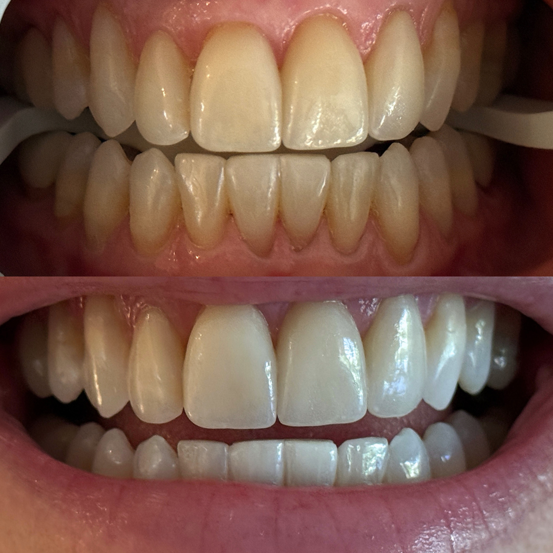 Copy of Copy of Copy of Copy of Copy of Copy of Copy of Copy of Copy of Copy of Copy of Copy of Copy of Copy of Copy of Copy of Copy of Copy of Copy of Copy of Copy of Copy of Copy of Copy of Copy 2.PNG