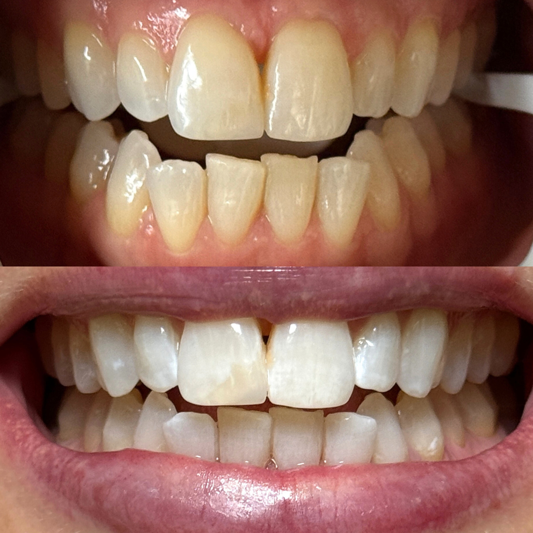 Copy of Copy of Copy of Copy of Copy of Copy of Copy of Copy of Copy of Copy of Copy of Copy of Copy of Copy of Copy of Copy of Copy of Copy of Copy of Copy of Copy of Copy of Copy of Copy of Copy.png.PNG