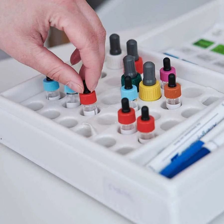 Allergiediagnostik