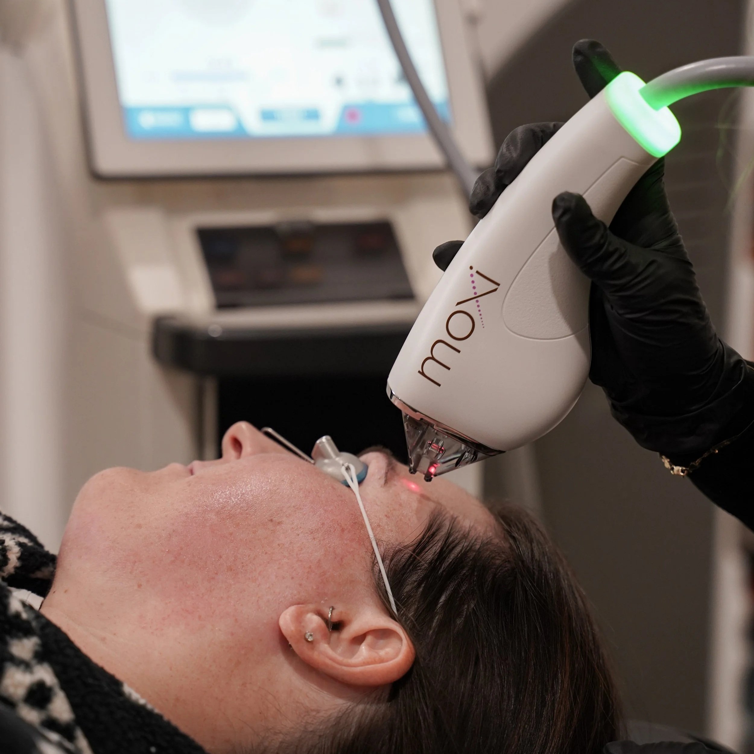 Thinking about Laser? Why MOXI® Laser Is A Client Favourite