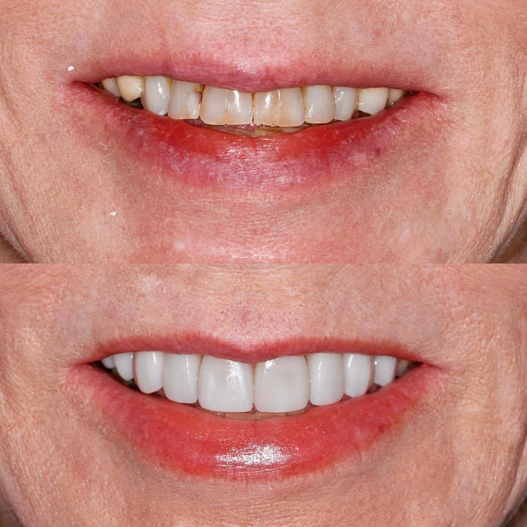 Gallery 1 — Morristown Dental Center