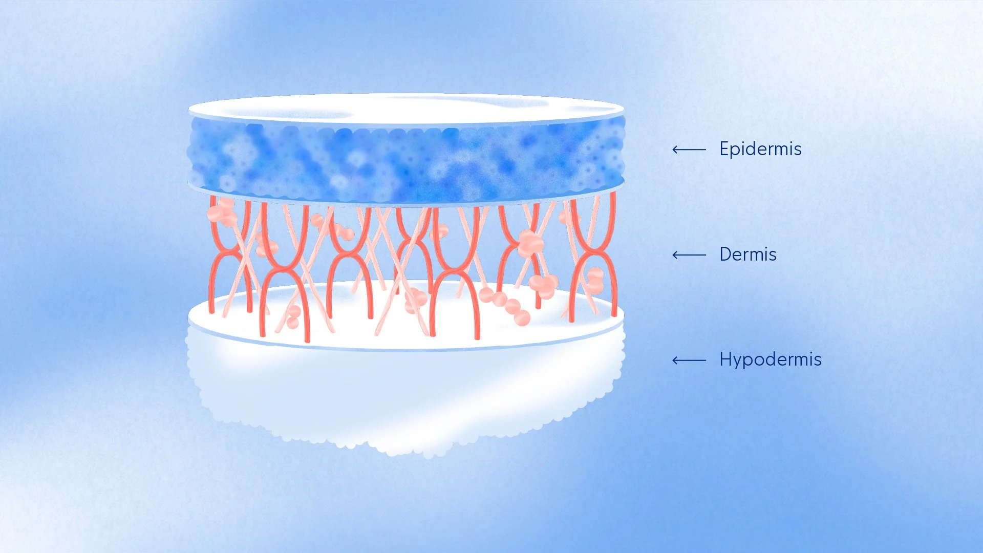 Diagram of skin layers showing epidermis, dermis, and hypodermis with labeled annotations