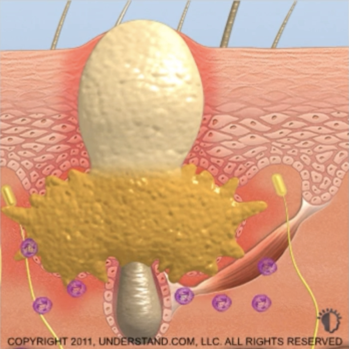A cross-sectional illustration of a skin pore being opened by a device, showing hair follicle and surrounding skin layers with nerve and blood vessel structures.