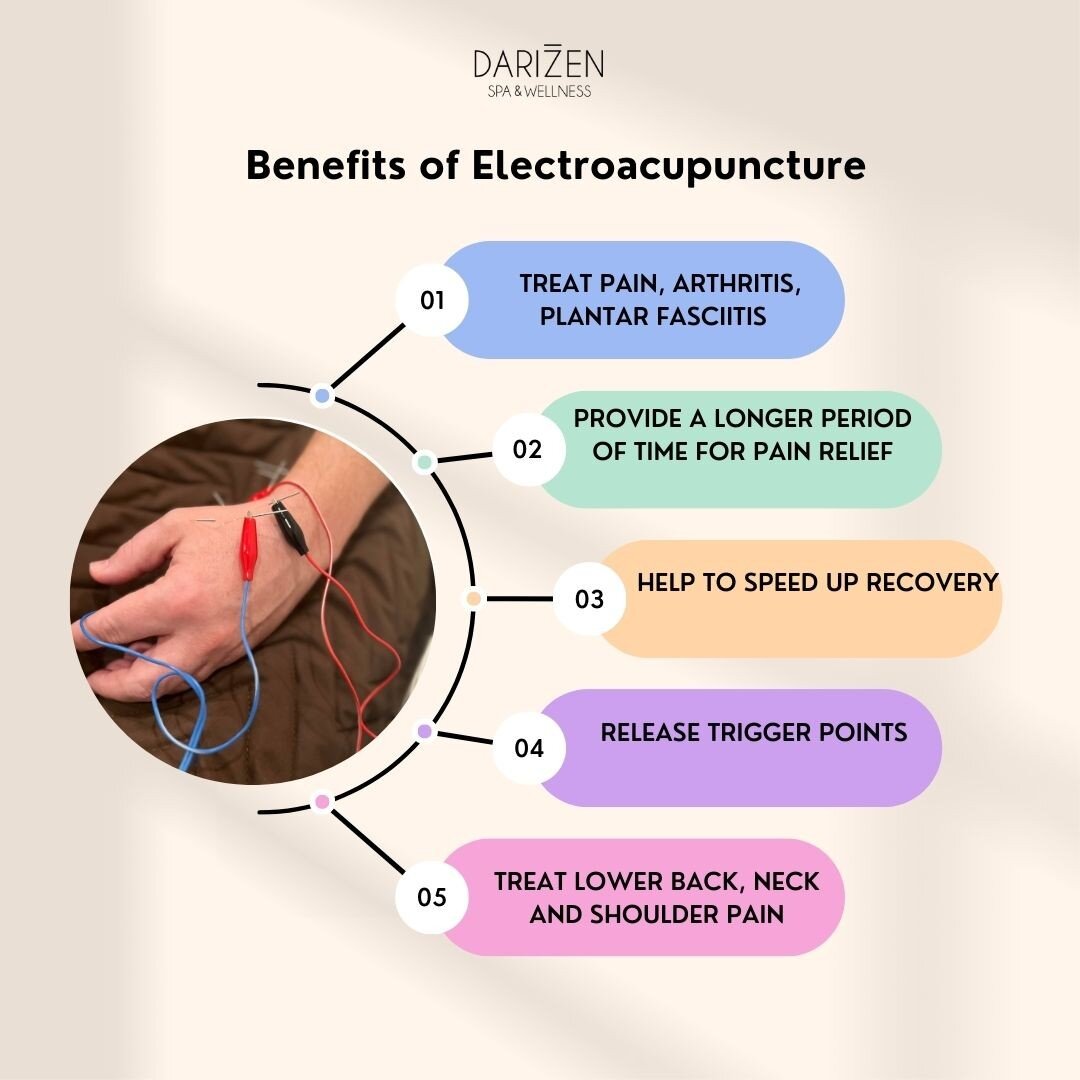 E L E C T R O A C U P U N C T U R E 
 
Is a modern variation of acupuncture. It uses electricity to enhance the benefits of this traditional therapeutic treatment. 

👉🏼 It helps to block your pain by activating bioactive chemicals in your body. Thi