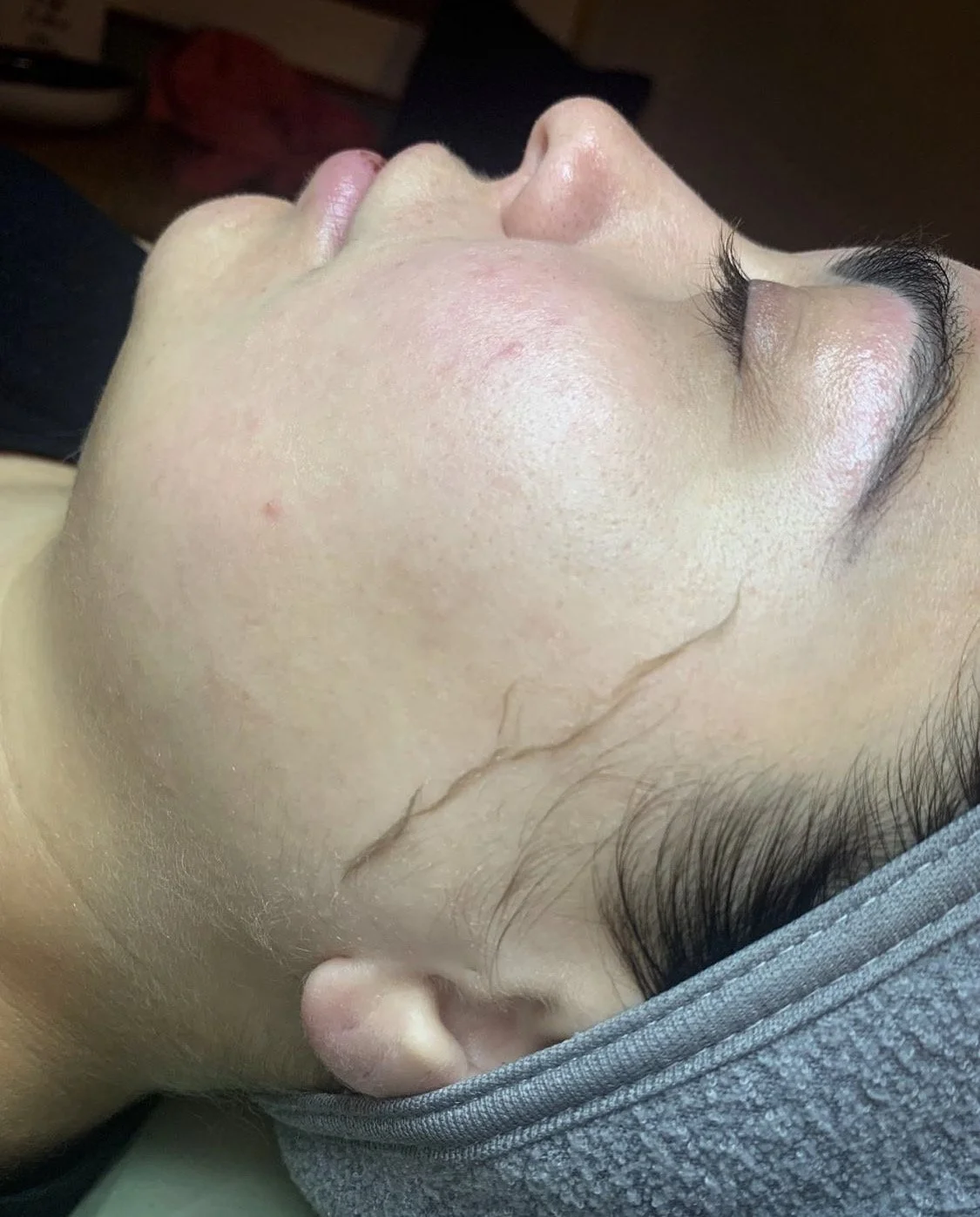 dermaplane facial in okc