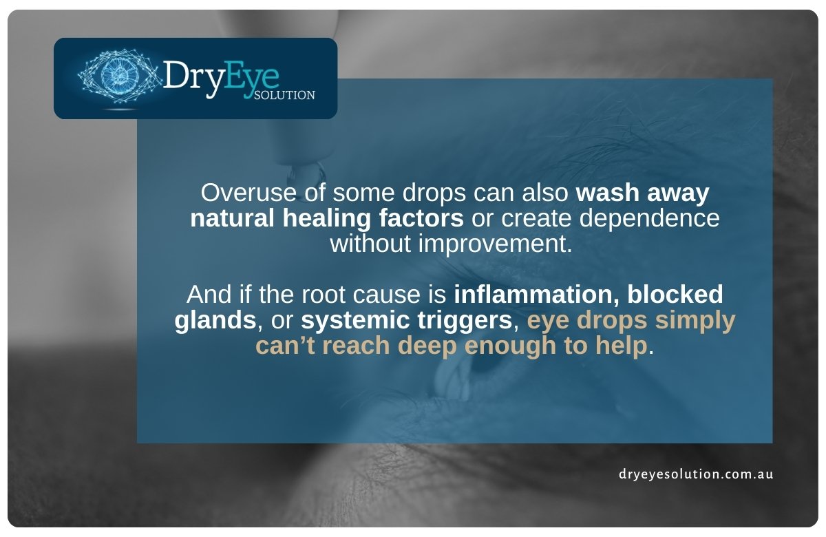 Burwood IPL for Dry Eye | Dry Eye Solution