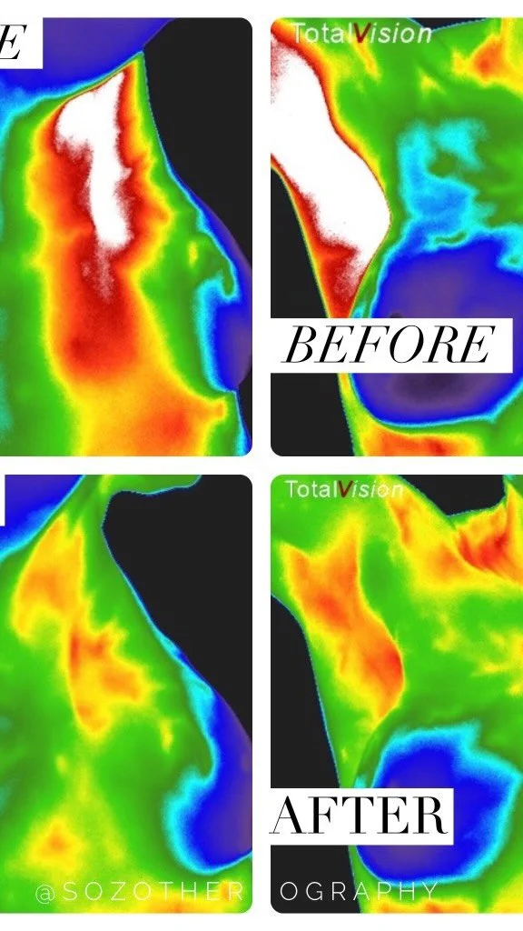 I love my follow up appointments with my clients.
Lots of aha moments about how simple it is to turn your health story around.
It doesn’t take much to see and feel a difference in how your body functions.
Thermography helps us get a snapshot
