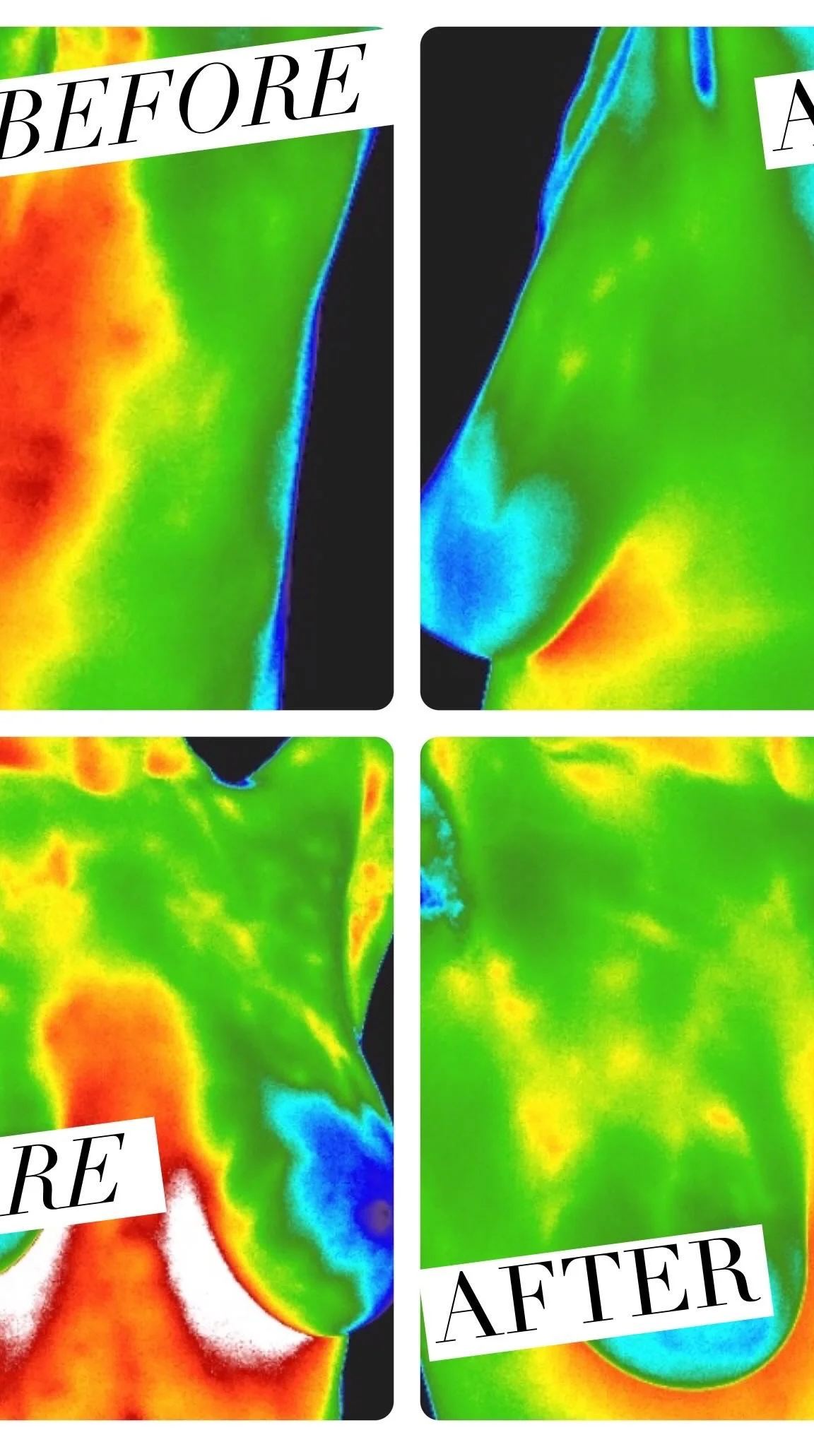Thermography is a radiation-free approach to health.
Infrared thermography, or thermal imaging, paints the picture of what is going on in your body currently. It gives us a visual of heat patterns and temperature changes on the surface.
This doesn&