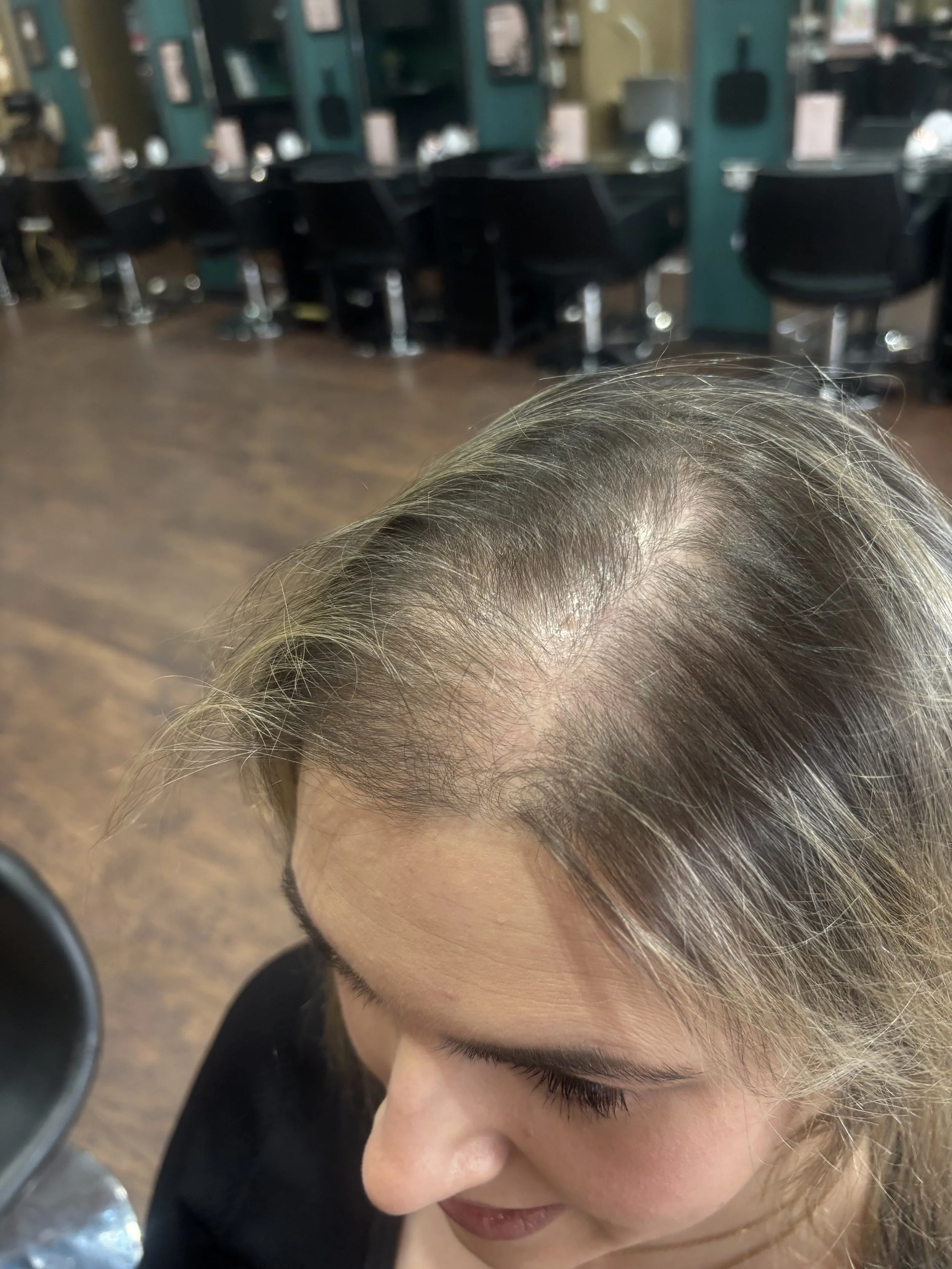 Close-up of a woman with thinning hair on top of her head, in a salon with black chairs and mirrors in the background.