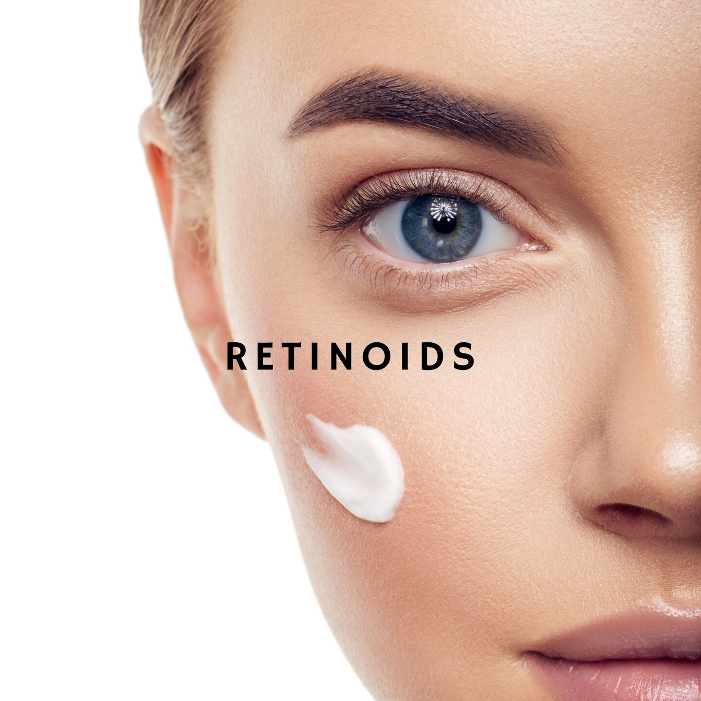 Retinoids are premier evidence-based cosmeceuticals, as they function through surface cell receptor interaction to produce a clinically defined effect. They consist of natural and synthetic derivatives of vitamin A that reduce hyperpigmentation and i