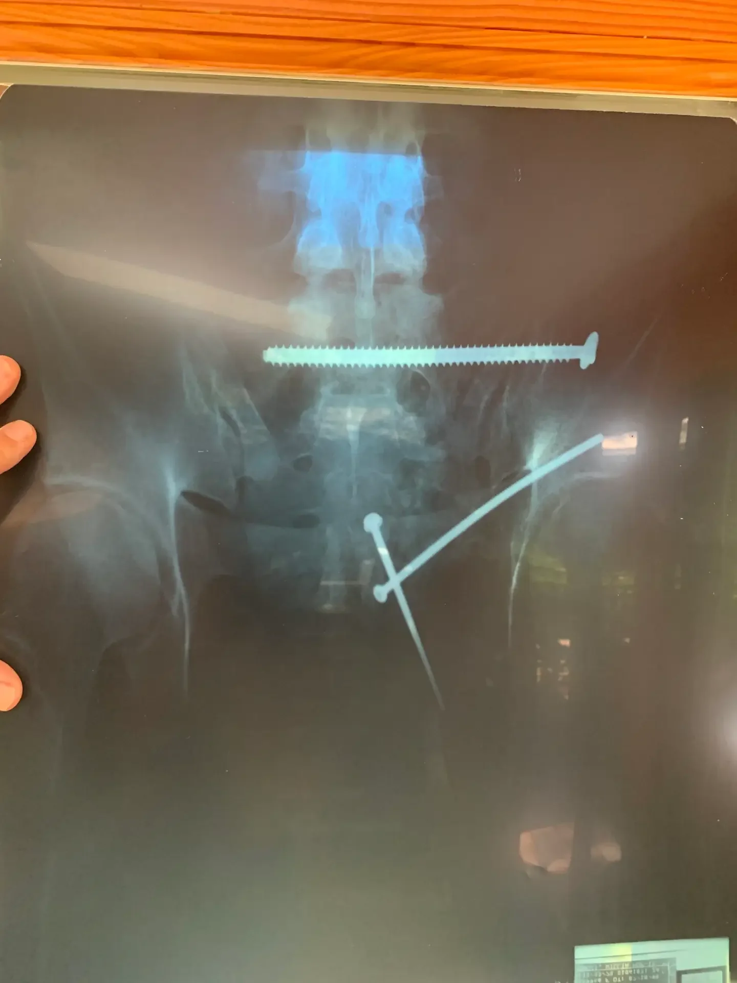eliza-xray--scaled.webp