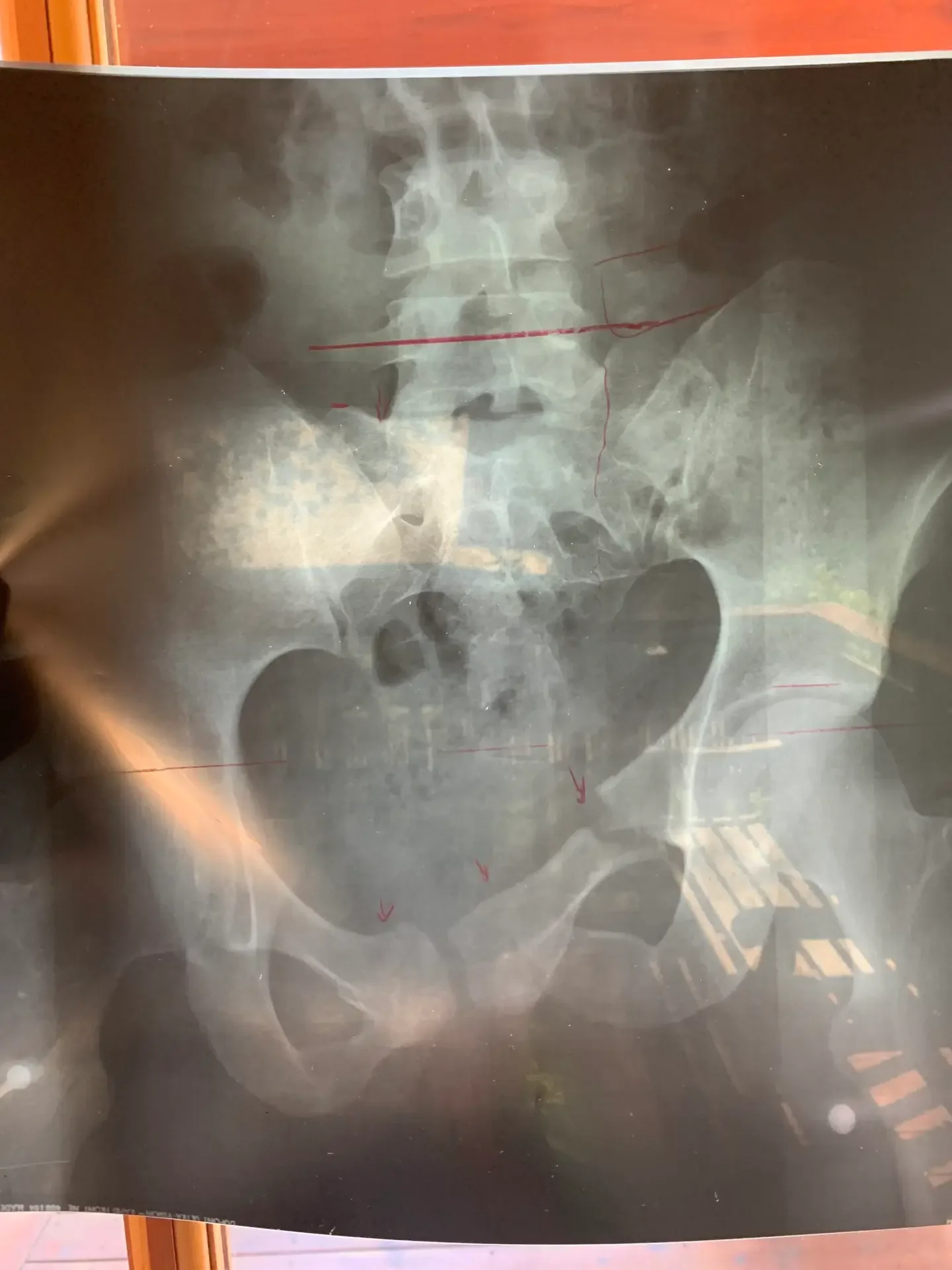 eliza-xray-2-scaled.webp