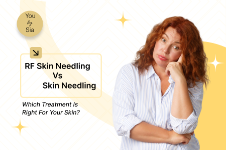 RF Skin Needling vs Skin Needling: Which Treatment is Right for Your Skin?&nbsp;