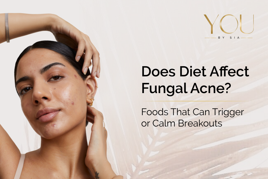 Laser Carbon Peel: A Professional Option for Skin Prone to Oil and Acne&nbsp;