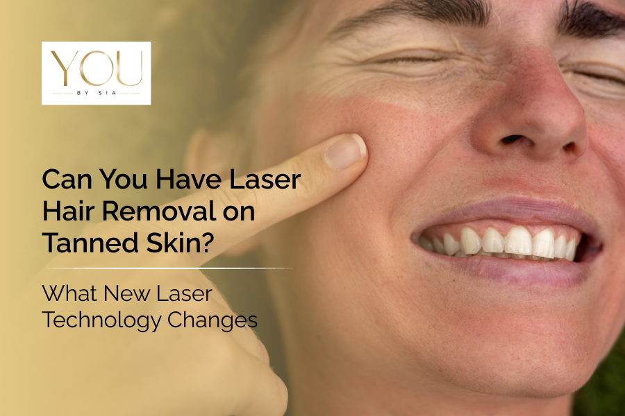 Can You Have Laser Hair Removal on Tanned Skin? What New Laser Technology Changes&nbsp;