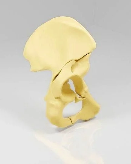 3D printed Model of a complex hip fracture HumanX