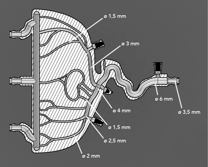 AngioPlayground Thrombectomy Model