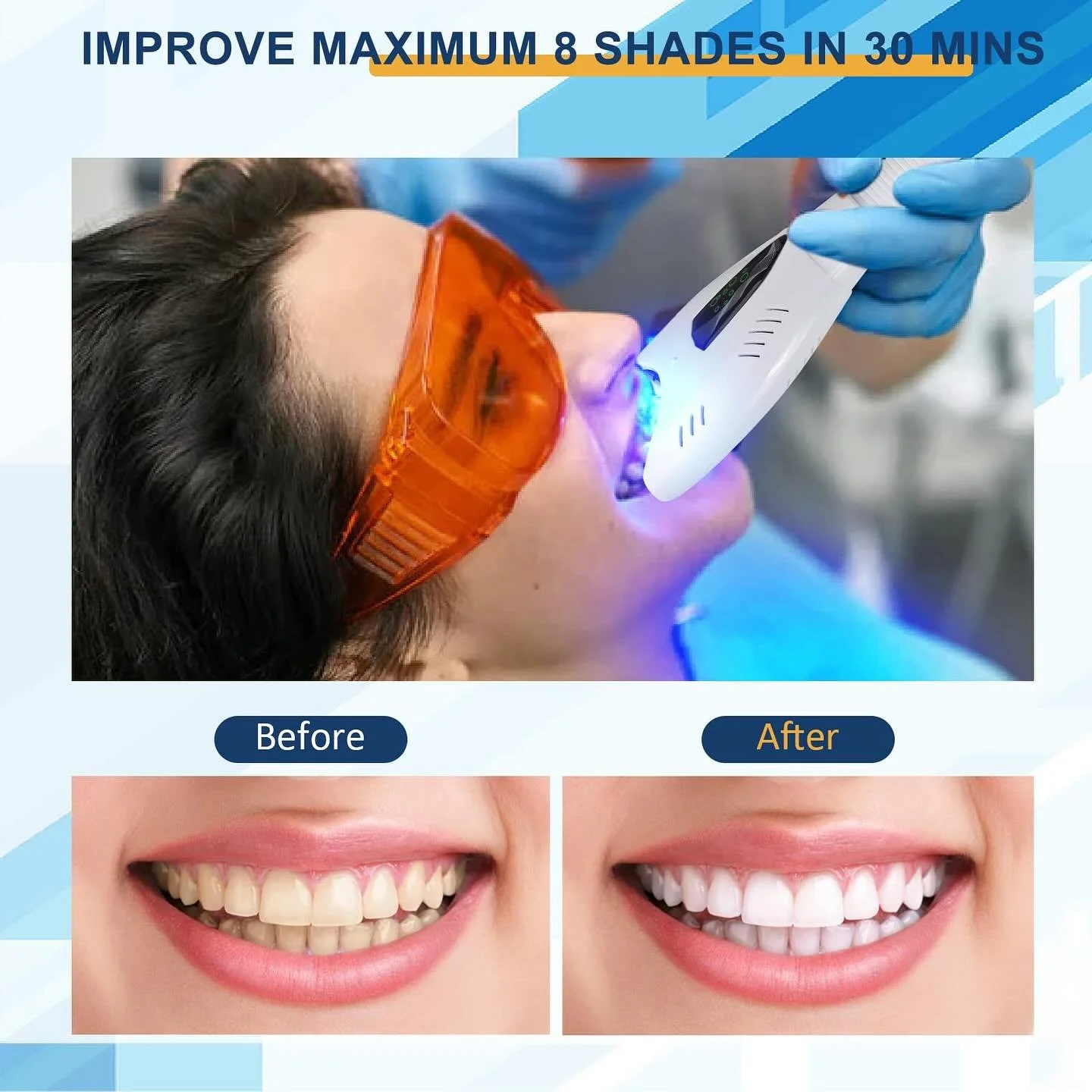 Ready to show off your brightest smile? 😁✨ Enjoy $100 OFF professional whitening for the month of December! Book now and let your smile shine. 💎 
Call our office for more information (828)-505-3410
#TeethWhitening #BrightSmile #asheville #dentist #