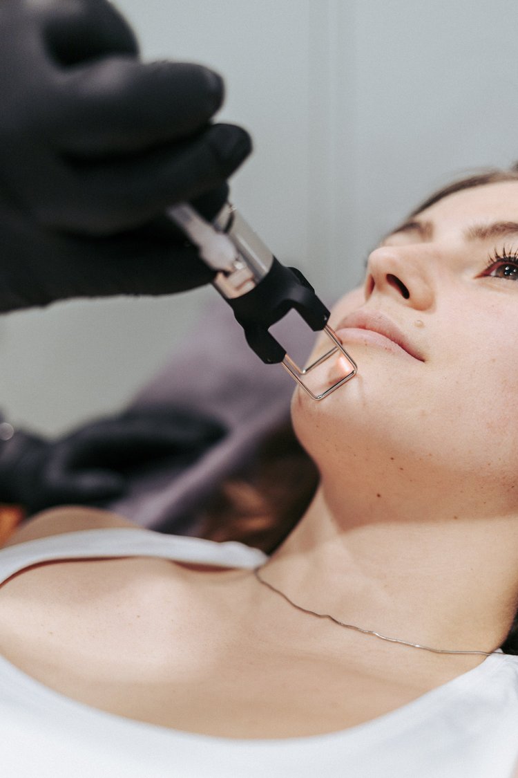 Séance CO2 fractionné en cabine — Centre Laser Villefranche