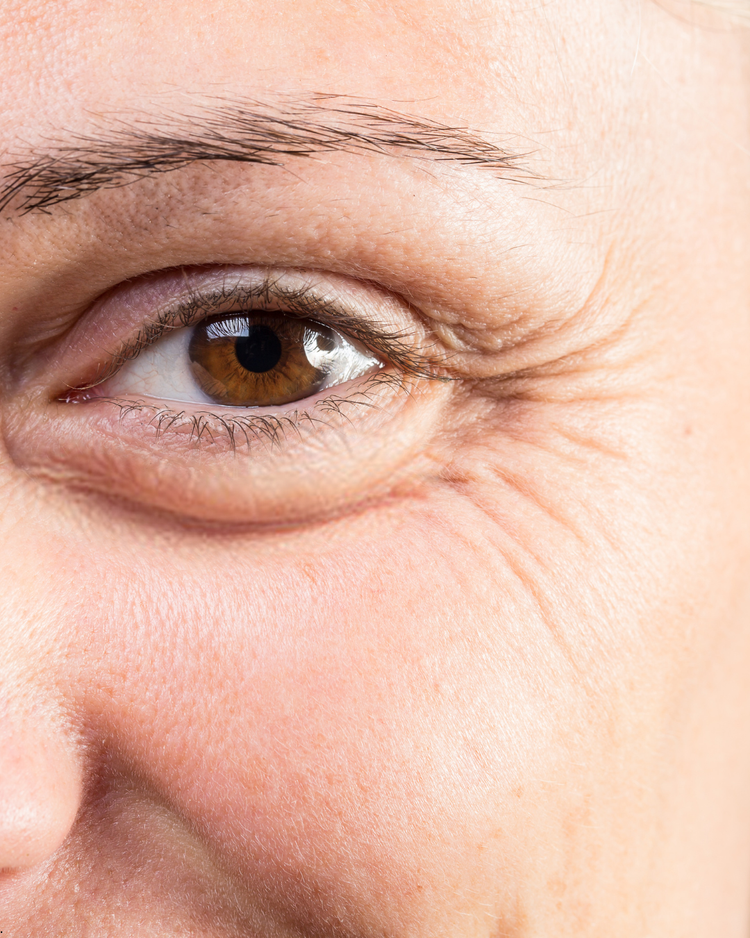 Blépharoplastie laser à Villefranche-sur-Saône — Centre Laser Villefranche