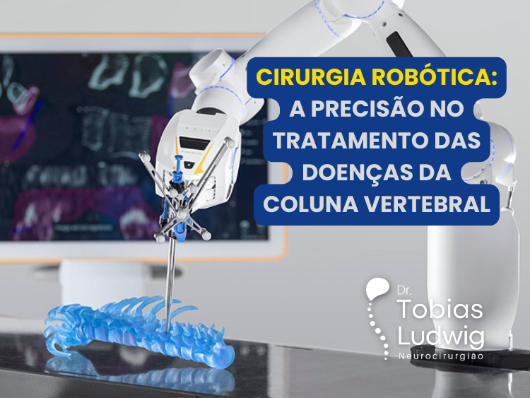 Cirurgia Robótica de Coluna: A Precisão no Tratamento das Doenças da Coluna Vertebral