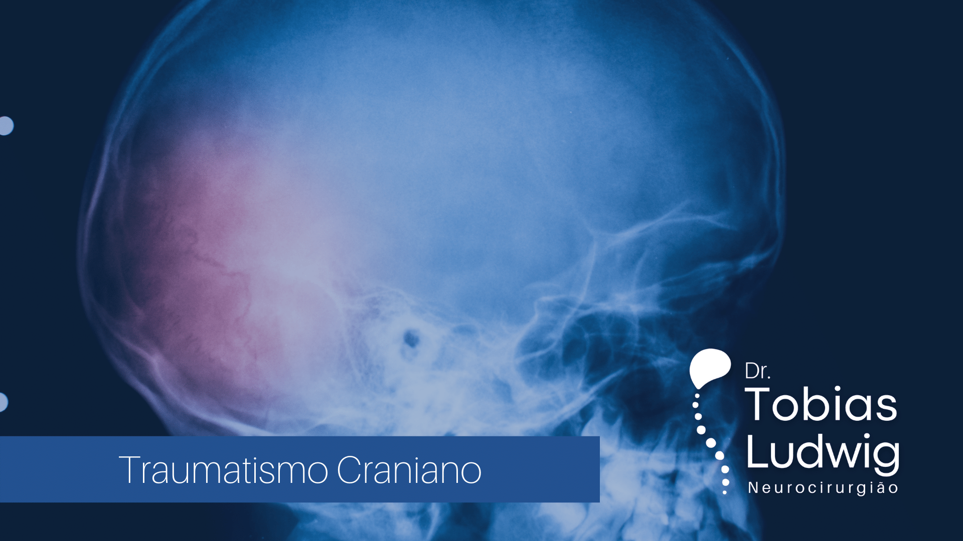 Cid Traumatismo Craniano Leve - RETOEDU