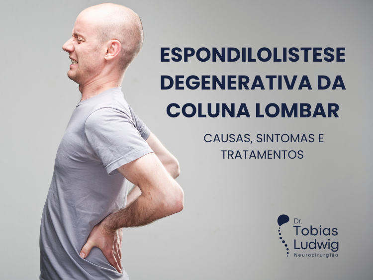Espondilolistese Degenerativa da Coluna Lombar: Causas, Sintomas e ...
