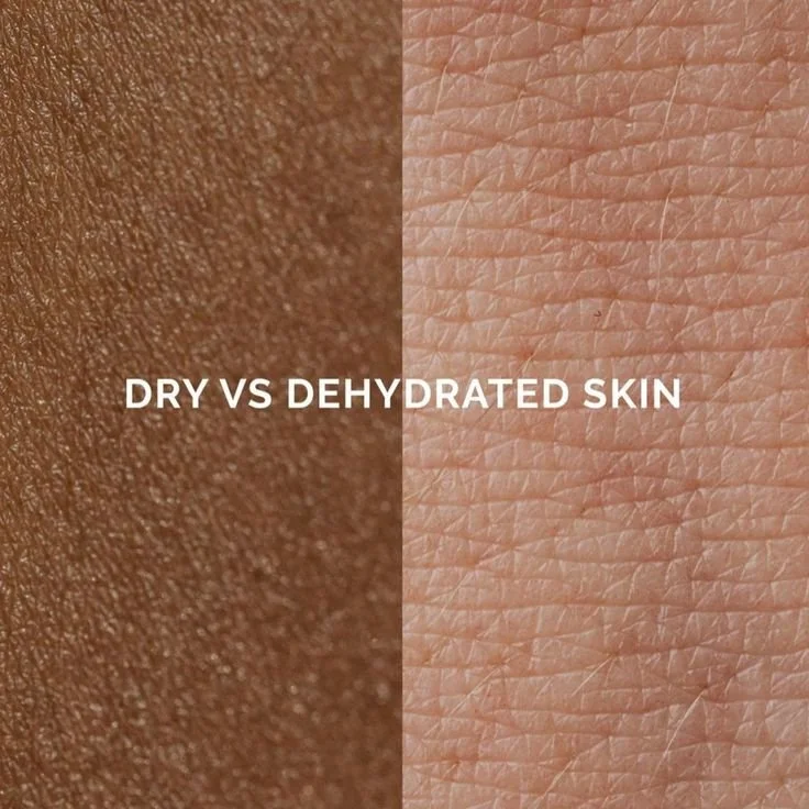 Dry vs. Dehydrated Skin: What’s Really Going On With Your Skin Barrier? 💧