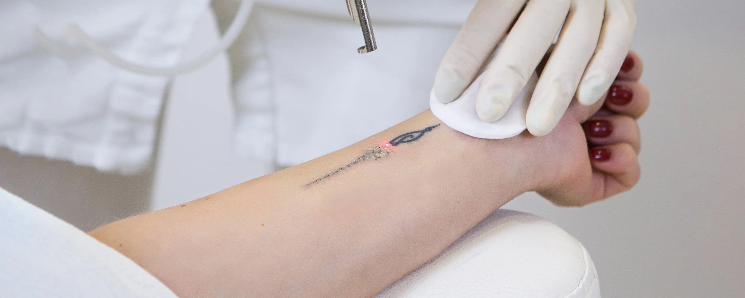 tattoo-removal-treatment.jpg