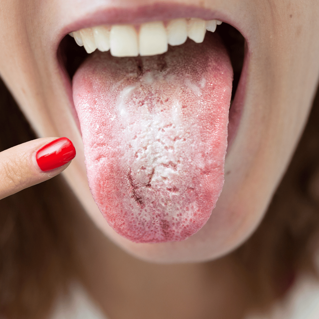 Lesson 2: Understanding Candida