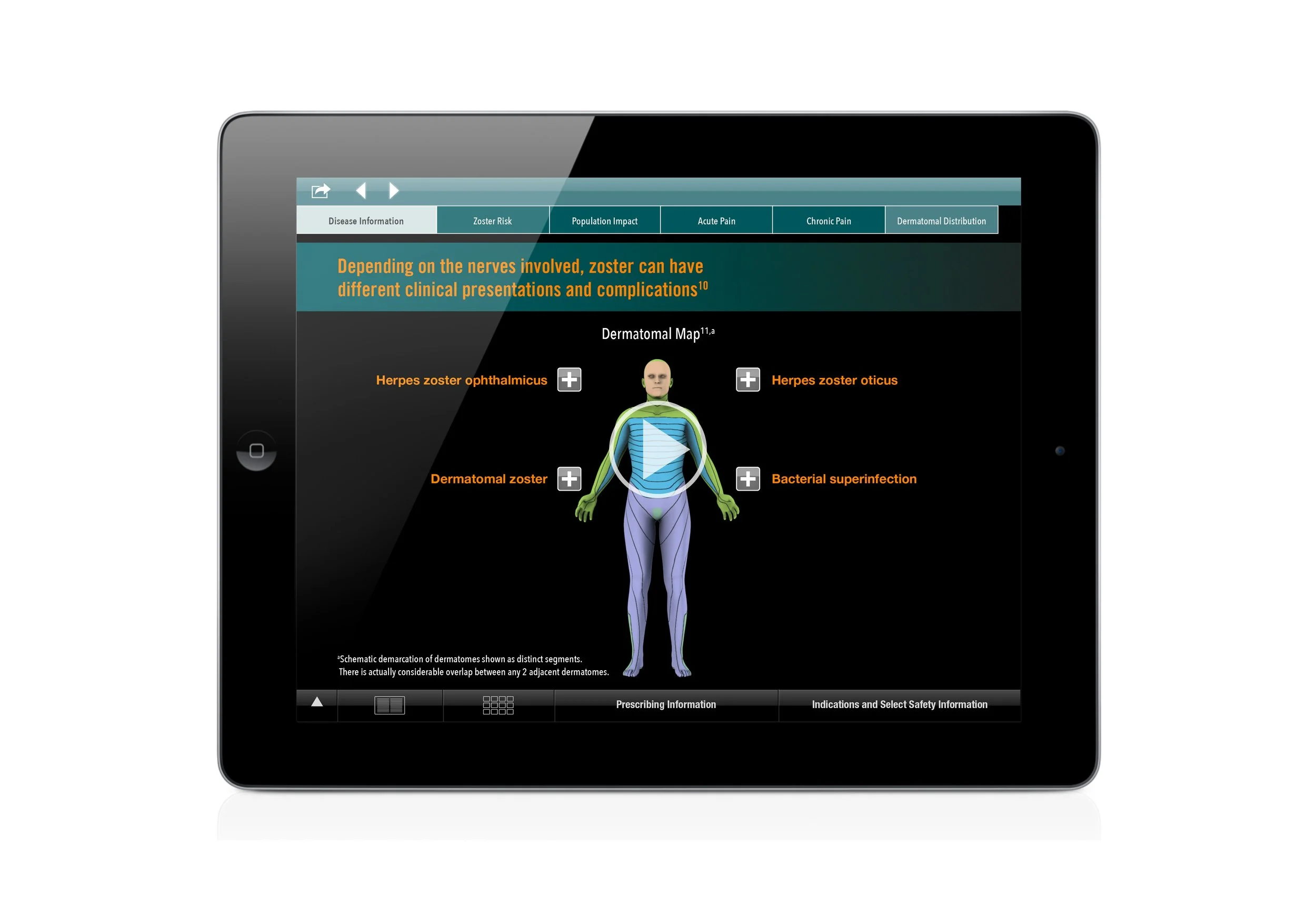 U.S. iPad Tool: Interactive, animated  dermatome map used to explain how
shingles affects nerves, its symptoms and potential complications that can vary significantly depending on the location and type of nerve involved.