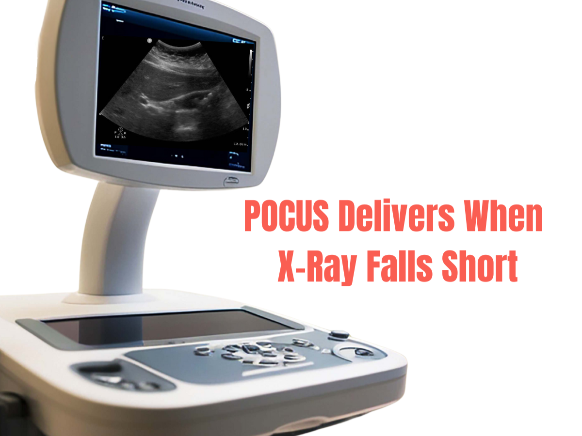 The New Backbone of Urgent Care Imaging: Why POCUS Matters Now
